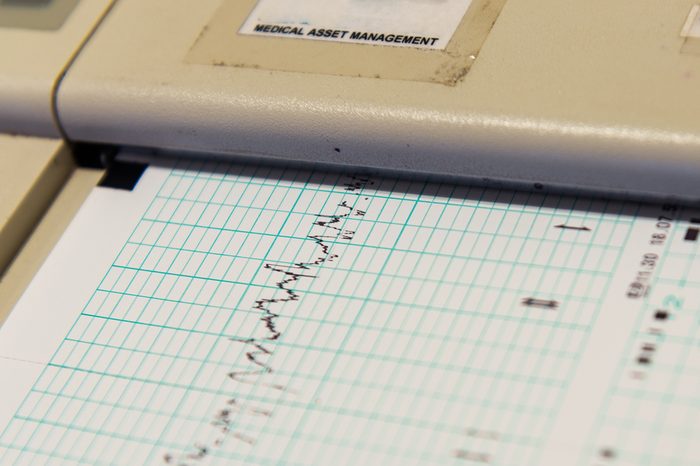Printing of cardiogram report coming out from Electrocardiograph. Richter scale.