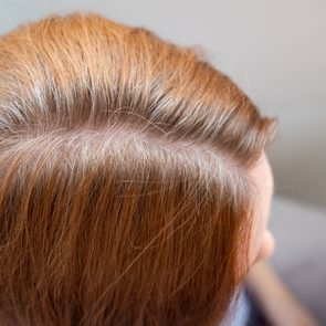 Hair shows a parting with reddish-brown color, revealing some grey strands, indoors on a person.